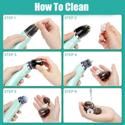 ASPIRADOR NASAL ELECTRICO